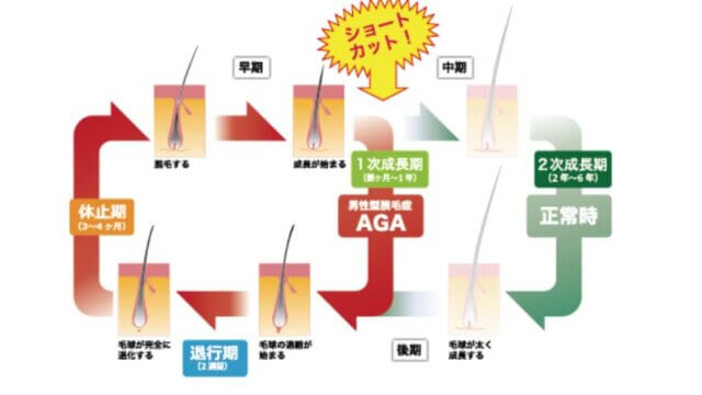 医師が教える ヘアサイクル 毛周期 メカニズムは クリスタル美容外科