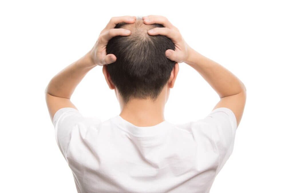 医師が教える Aga治療薬の種類と効果 副作用も紹介 クリスタル美容外科